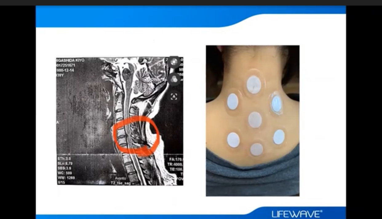 保護中: X39（LIFE WAVE）のパッチの貼り方と注意点、禁忌とは